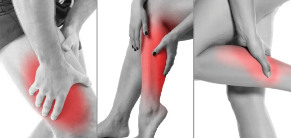 What Types of Muscle Cramps Are There